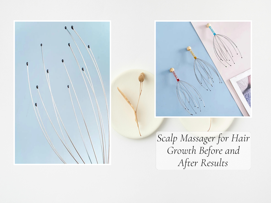 Scalp Massager for Hair Growth Before and After Results