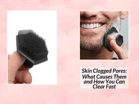 Skin Clogged Pores: What Causes Them and How You Can Clear Fast