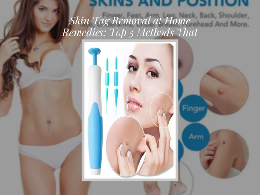 Skin Tag Removal at Home Remedies: Top 5 Methods That Work