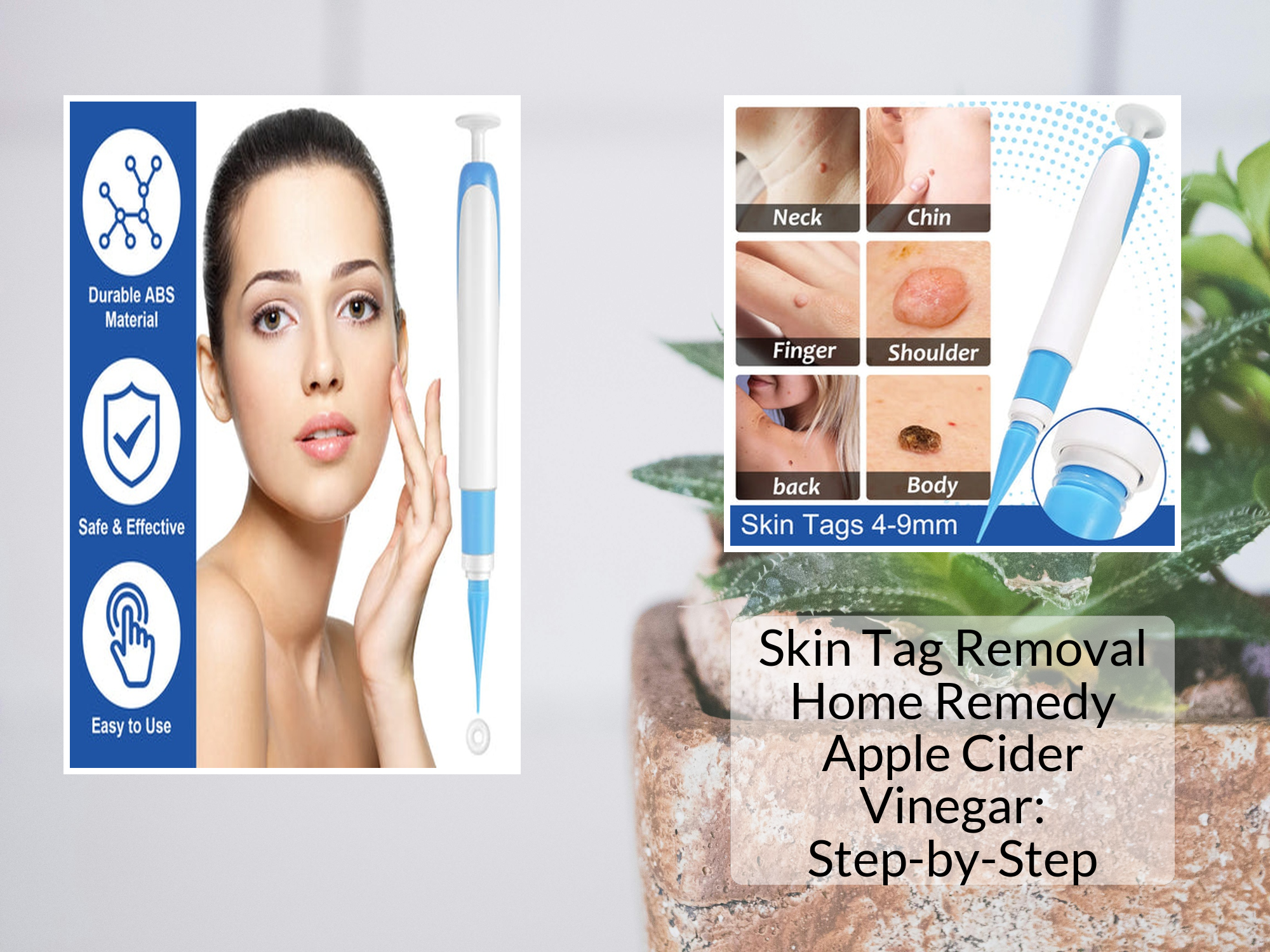 Skin Tag Removal Home Remedy Apple Cider Vinegar: Does It Hurt