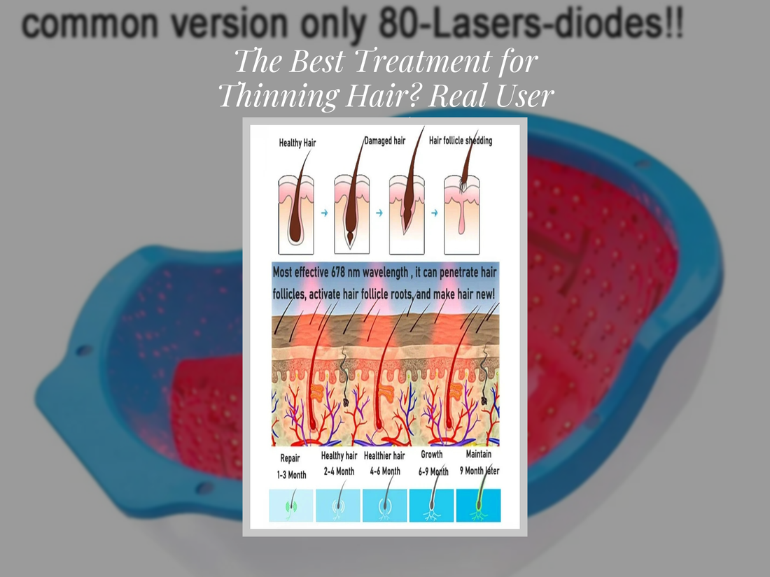 The Best Treatment for Thinning Hair? Real User Results