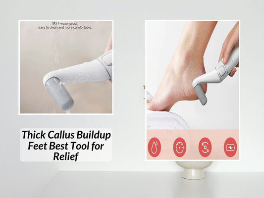 Thick Callus Buildup Feet Best Tool for Relief
