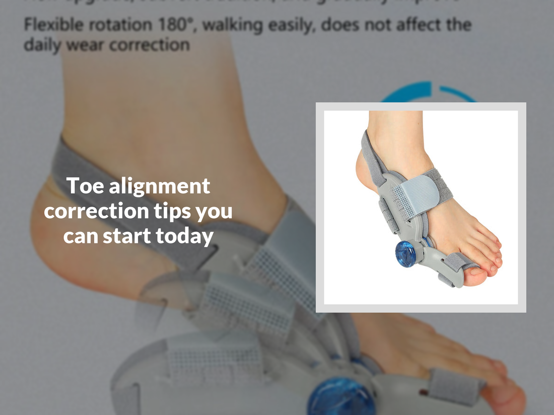 Toe alignment correction tips you can start today