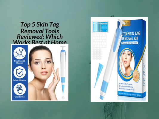 Top 5 Skin Tag Removal Tools Reviewed: Which Works Best at Home