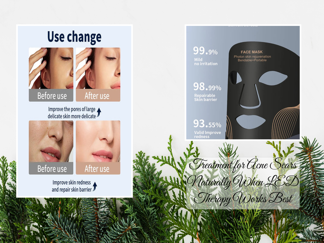 Treatment for Acne Scars Naturally When LED Therapy Works Best