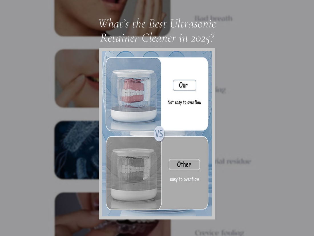 What’s the Best Ultrasonic Retainer Cleaner in 2025?