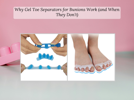 Why Gel Toe Separators for Bunions Work (and When They Don’t)