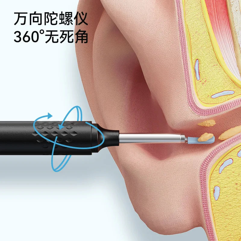 KentDO™ Wireless Visual Ear Cleaner