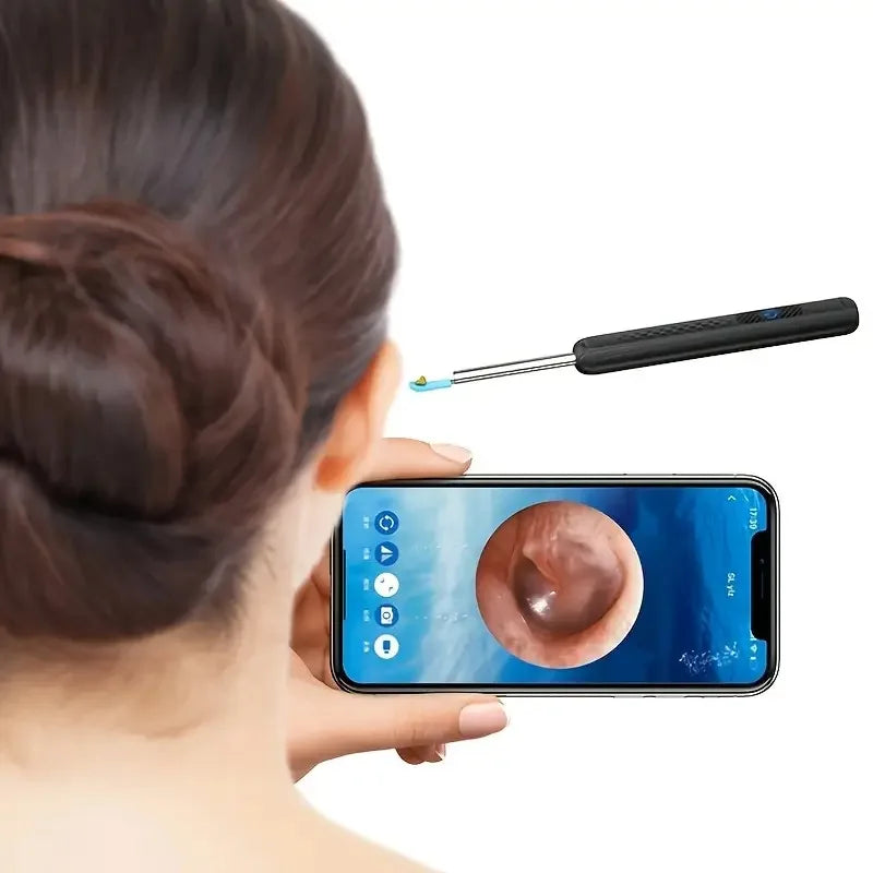 KentDO™ Wireless Visual Ear Cleaner