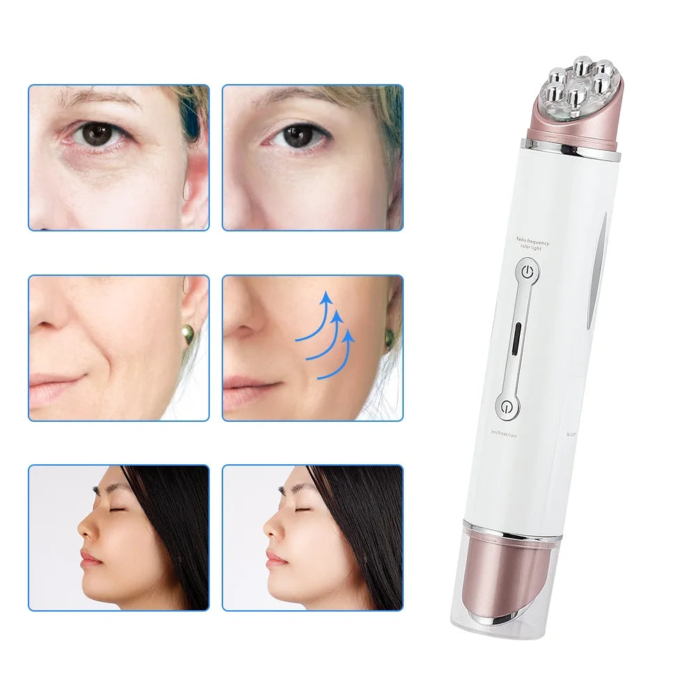 KentDO™ EMS Eye Massager – Anti-Wrinkle LED Therapy