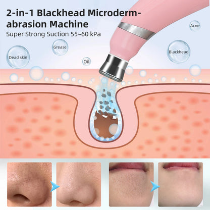 KentDO™ Diamond Microdermabrasion Machine for Smooth Skin