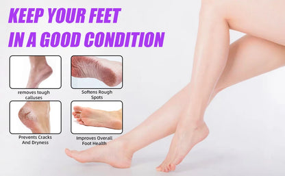 KentDO™ Electric Foot File – Smooth Heels & Callus Removal