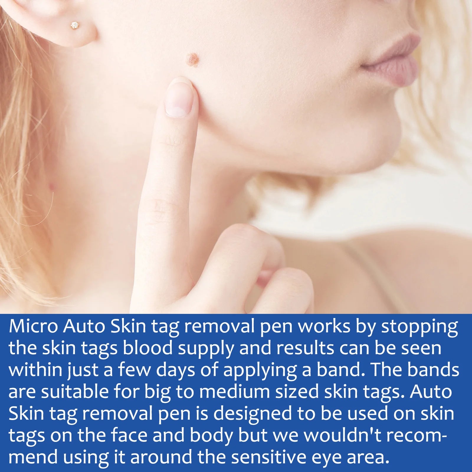 skin tag removal at home apple cider vinegar - KentDO
