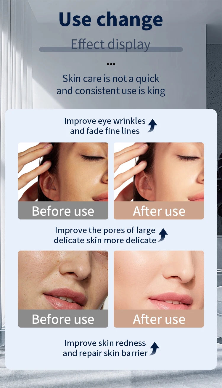 KentDO™ 7 Color LED Face Mask for Skin Rejuvenation