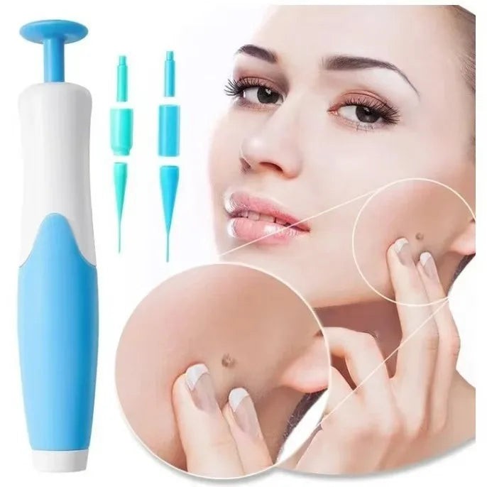 does it hurt to get skin tags removed - KentDO