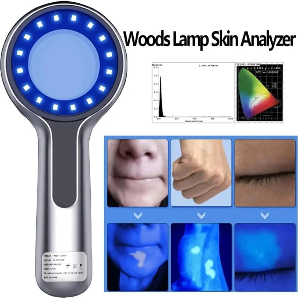 Wood’s Lamp Skin Analyzer – 16 LED UV Deep Scan Tool