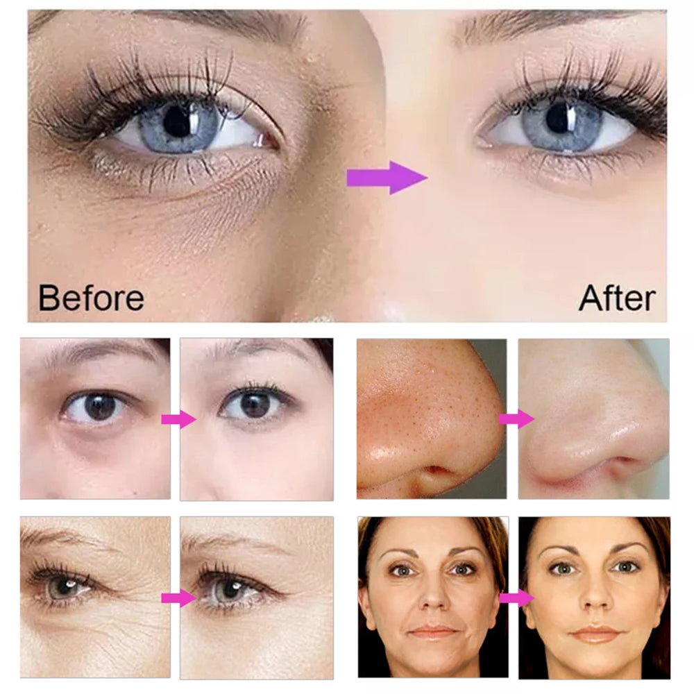 KentDO™ Electroporation Facial Device for Firming & Cooling