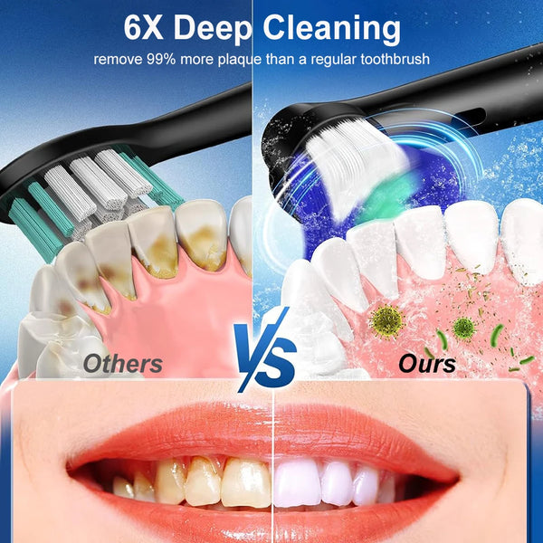 Electric toothbrush with gentle setting for sensitive gums - KentDO