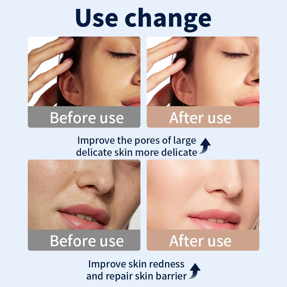 KentDO™ 7 Color LED Face Mask for Skin Rejuvenation