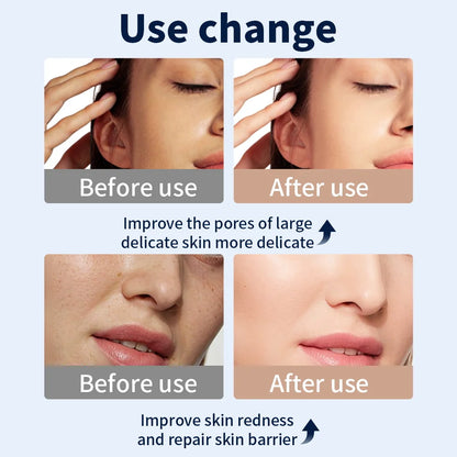 KentDO™ 7 Color LED Face Mask for Skin Rejuvenation