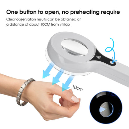 KentDO™ Woods Lamp Skin Analyzer for Accurate Skin Testing