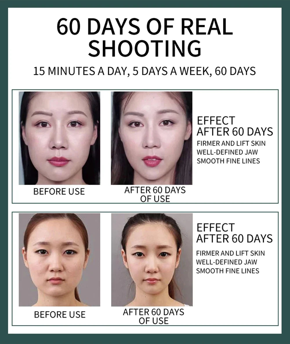 KentDO™ Microcurrent Face Massager for Lifting & Firming