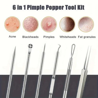 KentDO™ 6Pcs Pimple Tweezers Set – Pro Acne Care Tool