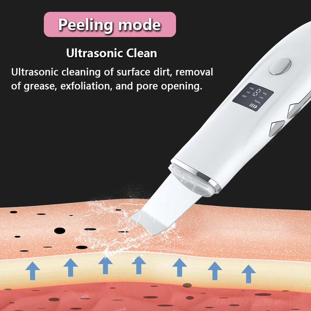 KentDO™ Ultrasonic Face Scrubber – Deep Pore Cleansing