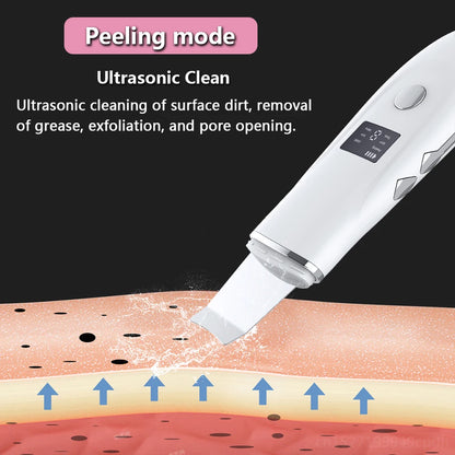 KentDO™ Ultrasonic Face Scrubber – Deep Pore Cleansing