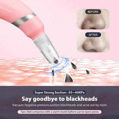KentDO™ Diamond Microdermabrasion Machine for Smooth Skin