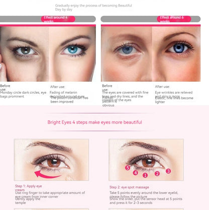 KentDO™ Electric Eye Massager – Reduce Puffiness & Fine Lines