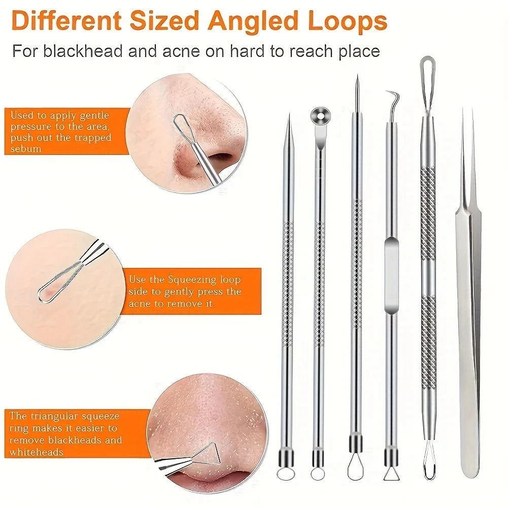 KentDO™ Pimple Popper Tool Kit – Clear Skin Blackhead Remover
