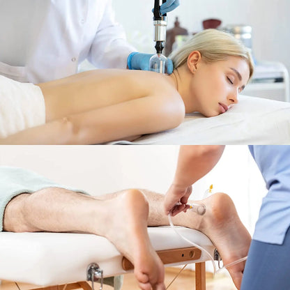 Vacuum Cupping Therapy Set for Deep Tissue Pain Relief