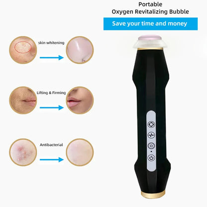 KentDO™ CO2 Oxygen Facial Device – Wrinkle & Skin Rejuvenator