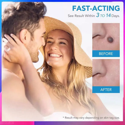 KentDO™ Double Head Wart Remover Pen – Safe Skin Tag Removal