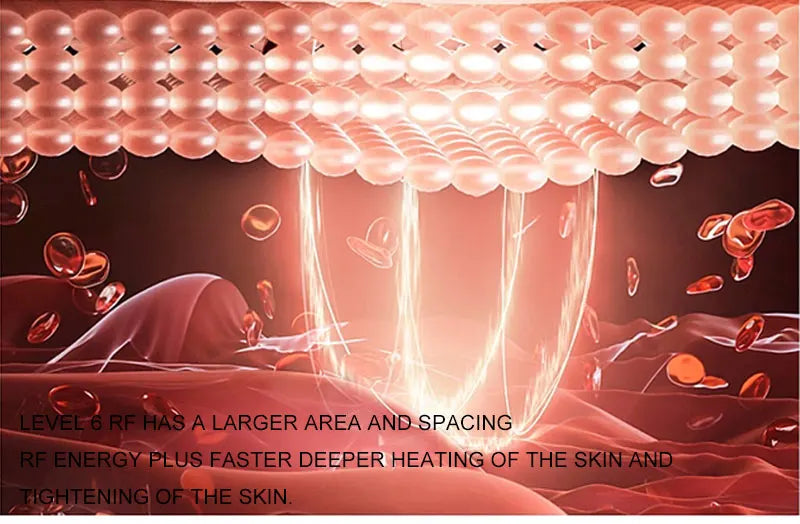 KentDO™ EMS RF Facial & Body Machine | Skin Tightening