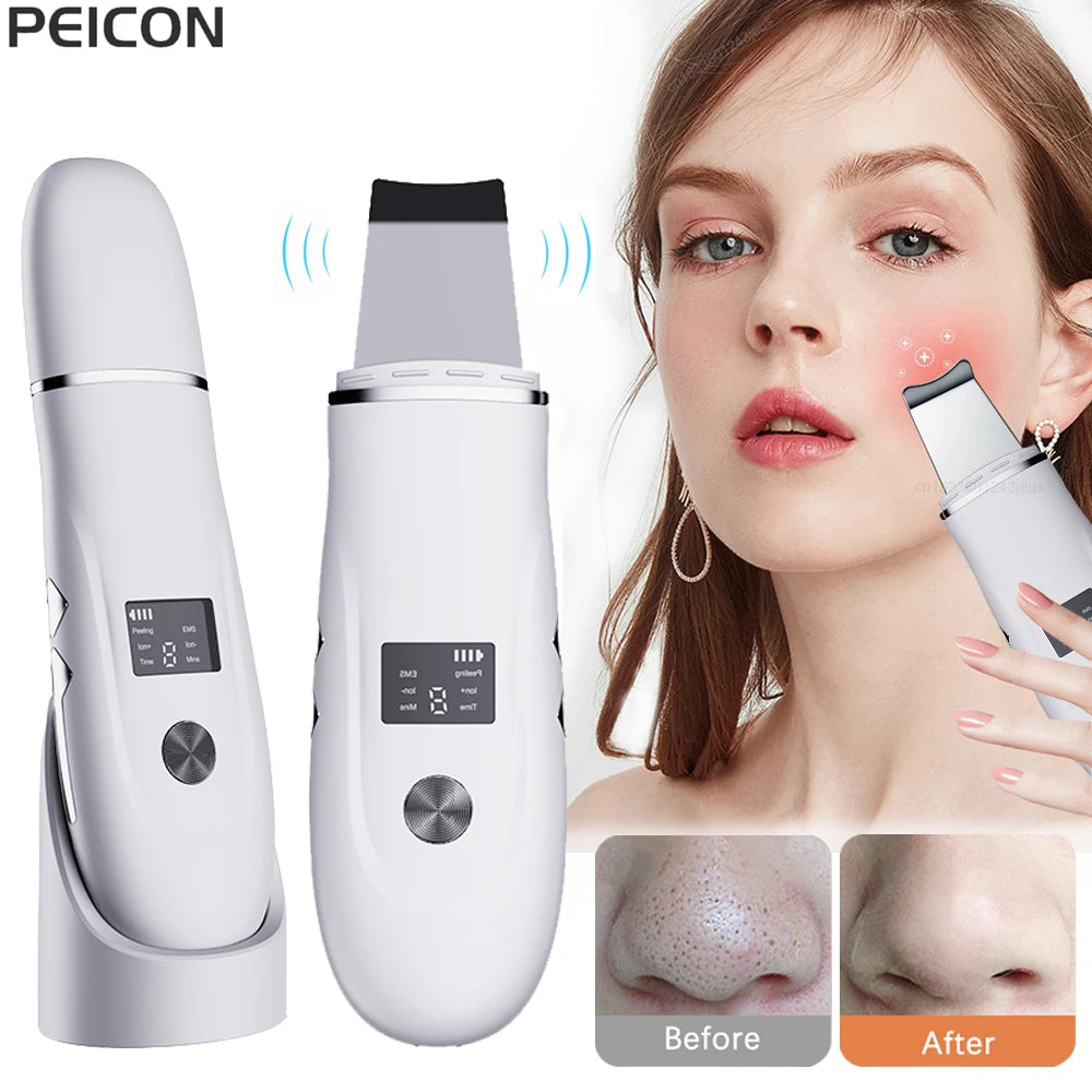 KentDO™ Ultrasonic Face Scrubber – Deep Pore Cleansing