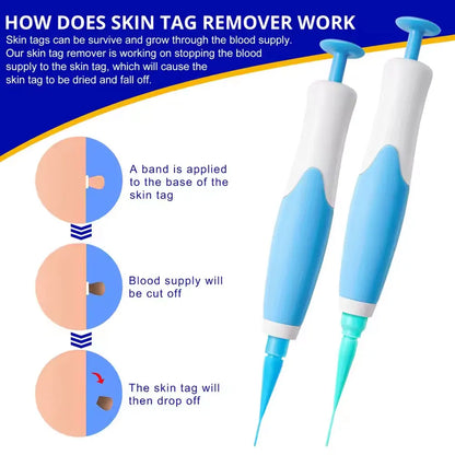 KentDO™ Double Head Wart Remover Pen – Safe Skin Tag Removal