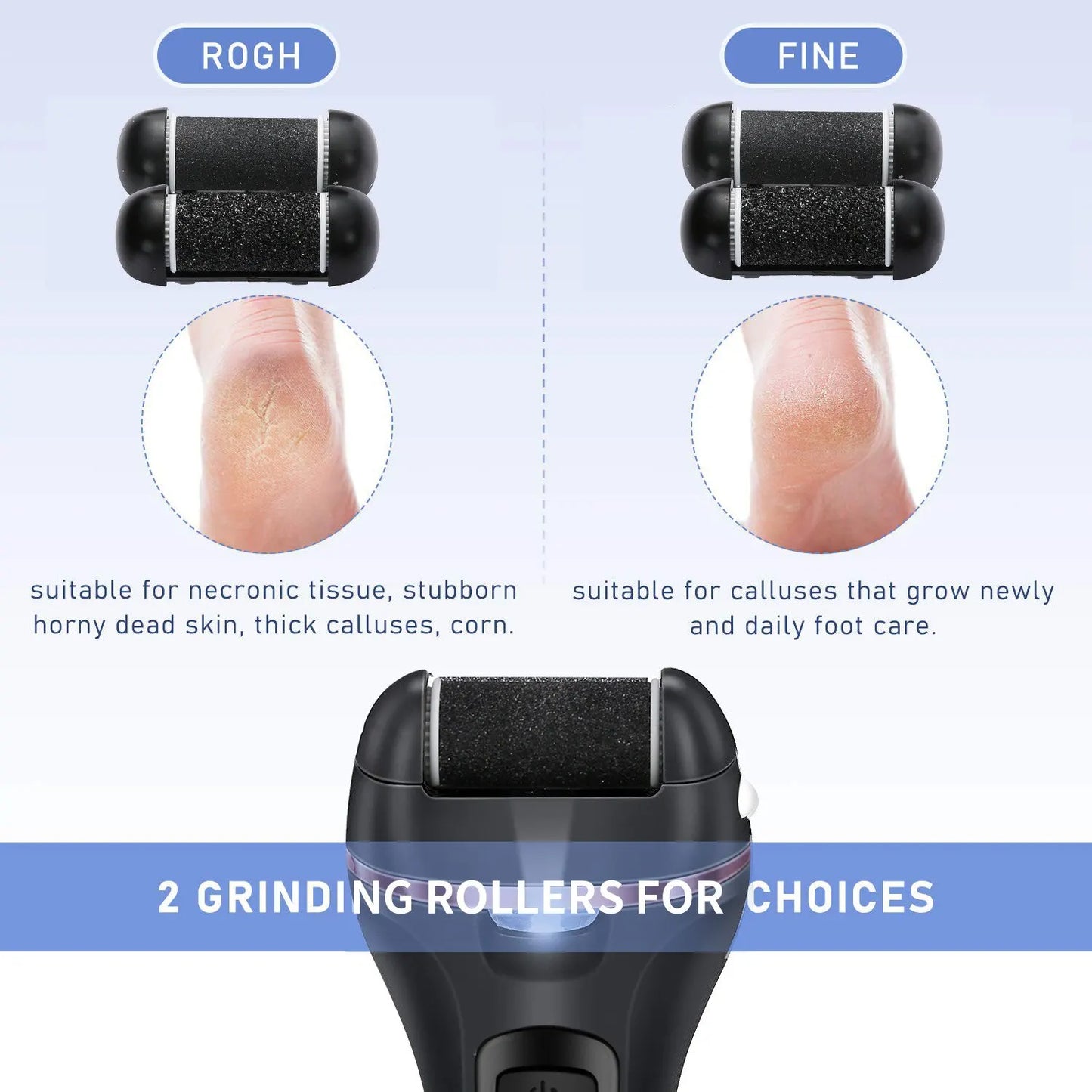 KentDO™ Electric Foot Callus Remover – Pro Pedicure Tool