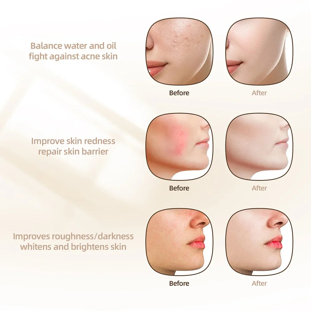KentDO™ 7-Color LED Silicone Face Mask for Skin Repair & Brightening