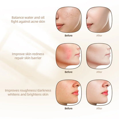 KentDO™ 7-Color LED Silicone Face Mask for Skin Repair & Brightening