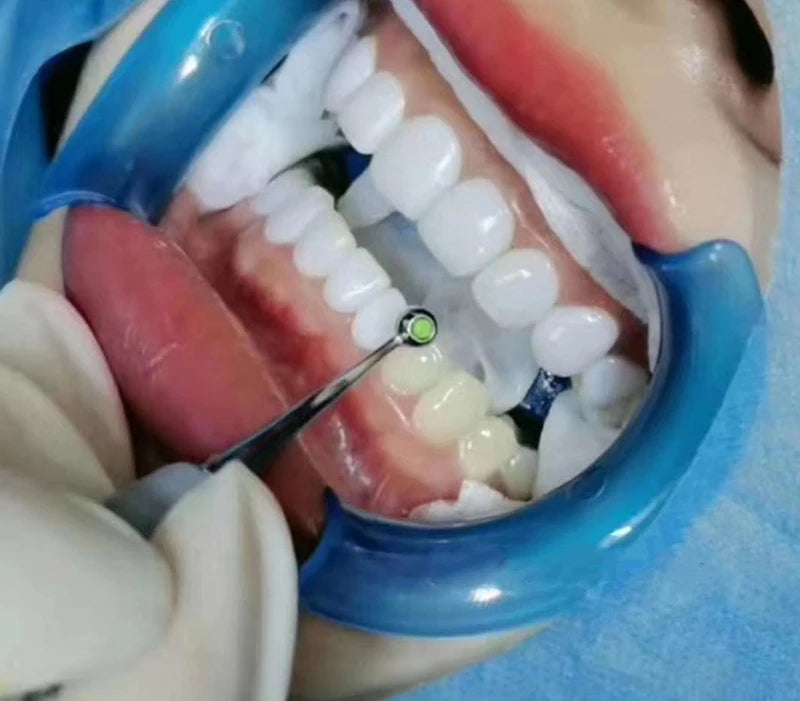 KentDO™ Dental Resin Filling Spatula & Molding Pad Set