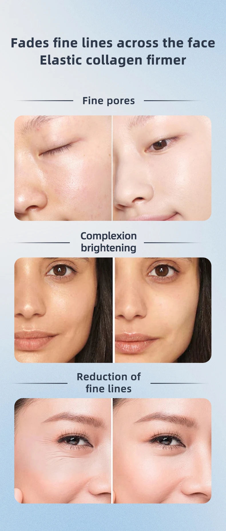 KentDO™ 3-in-1 RF EMS Face Roller – Lift & Firm Skin