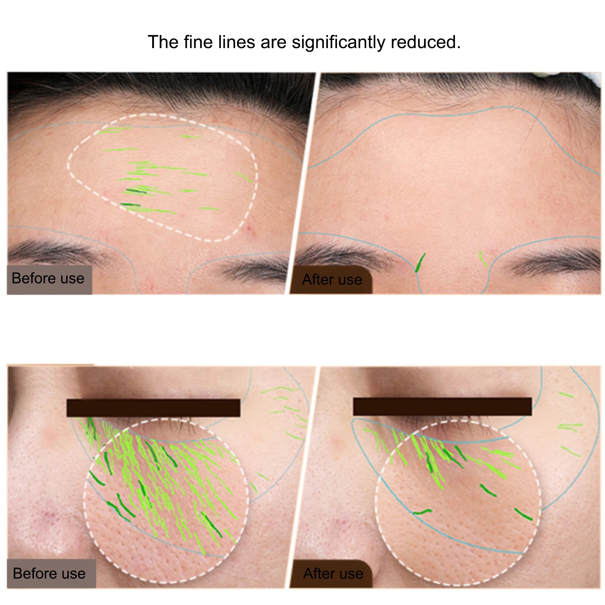 loose skin on face - KentDO