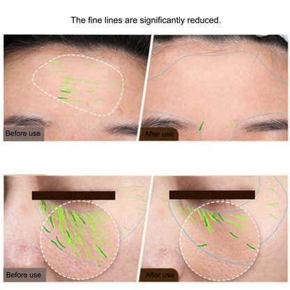 KentDO™ EMS RF Facial & Body Machine | Skin Tightening