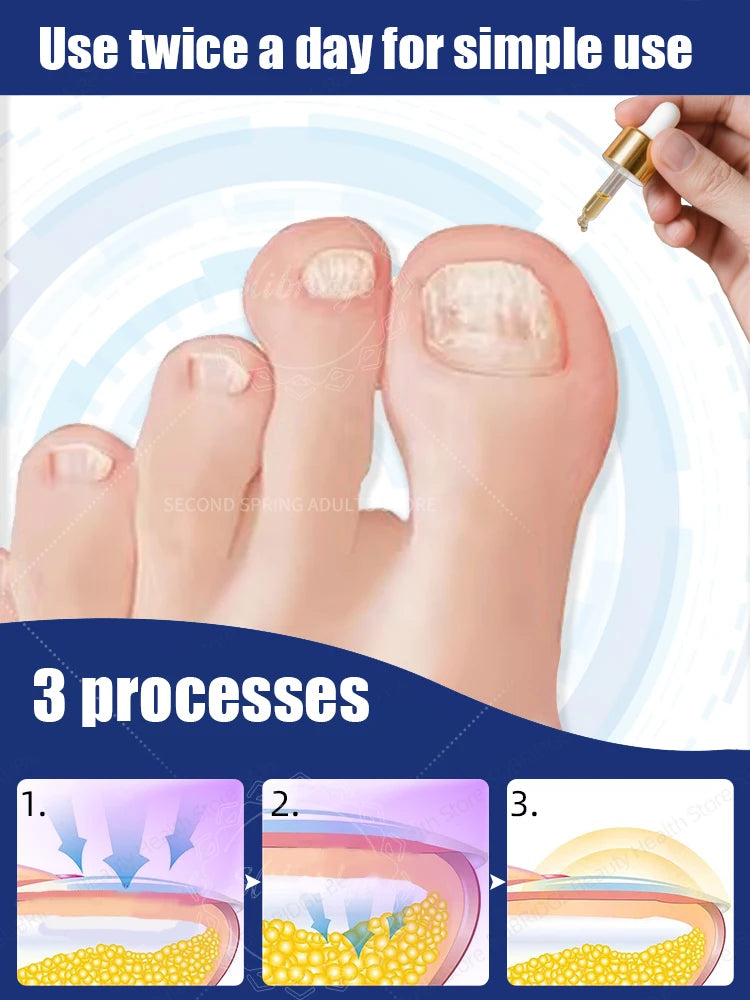 KentDO™ Toenail Fungus Patch – Waterproof Nail Repair Solution