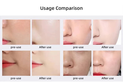 KentDO™ CO2 Oxygen Facial Device – Wrinkle & Skin Rejuvenator