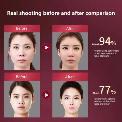 KentDO™ LED V-Face Massager – Lift, Slim & Rejuvenate Skin