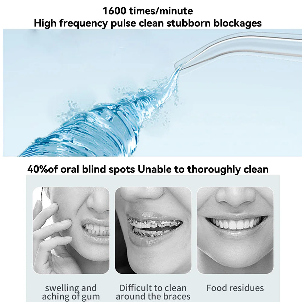 KentDO™ Portable Water Flosser – 3 Modes, 200ML Tank