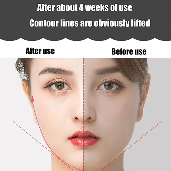 anti-aging wrinkle massager - KentDO